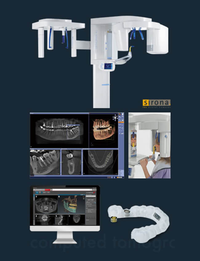 歯科用CT