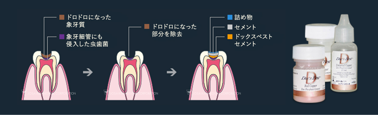 ドックスベストセメント