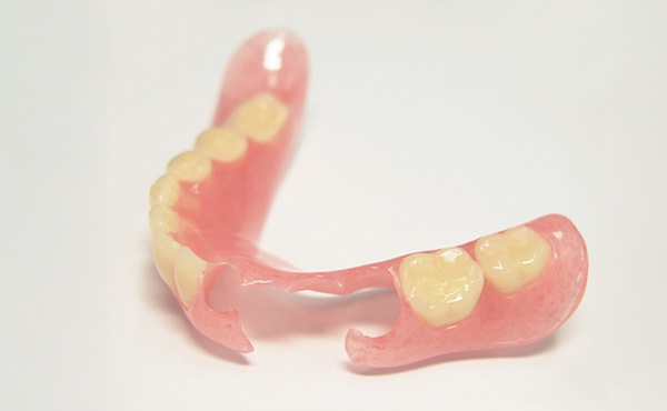 ノンクラスプデンチャー