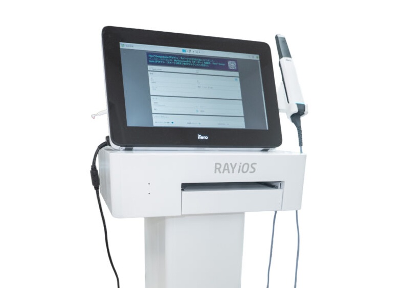 最新スキャナー「iTero」で快適・スピーディー